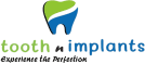 Tooth N Implants